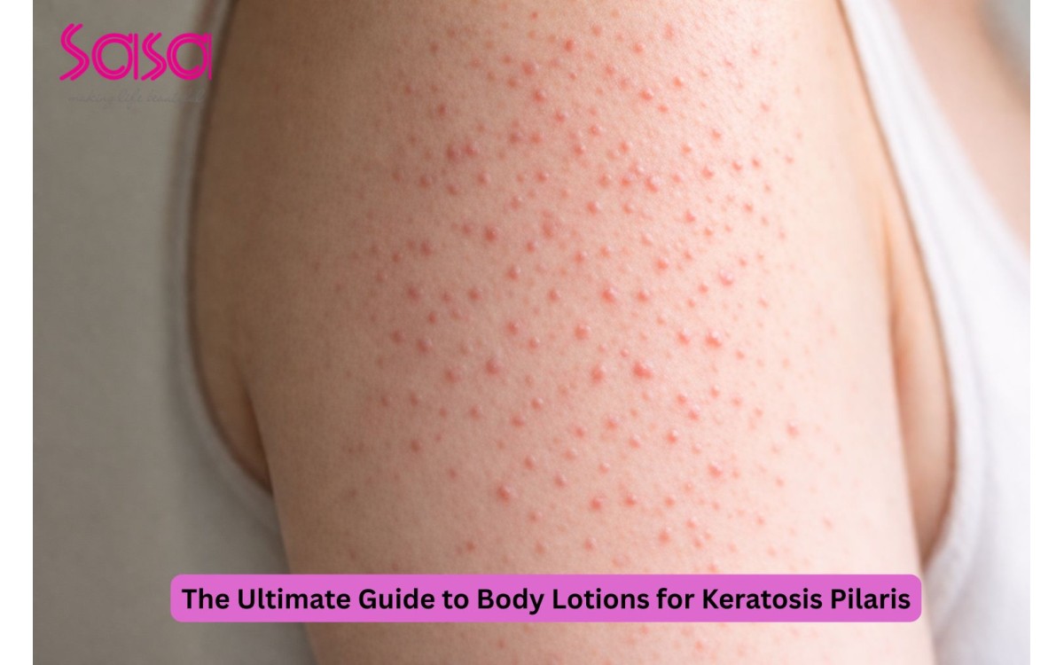 The Ultimate Guide to Body Lotions for Keratosis Pilaris