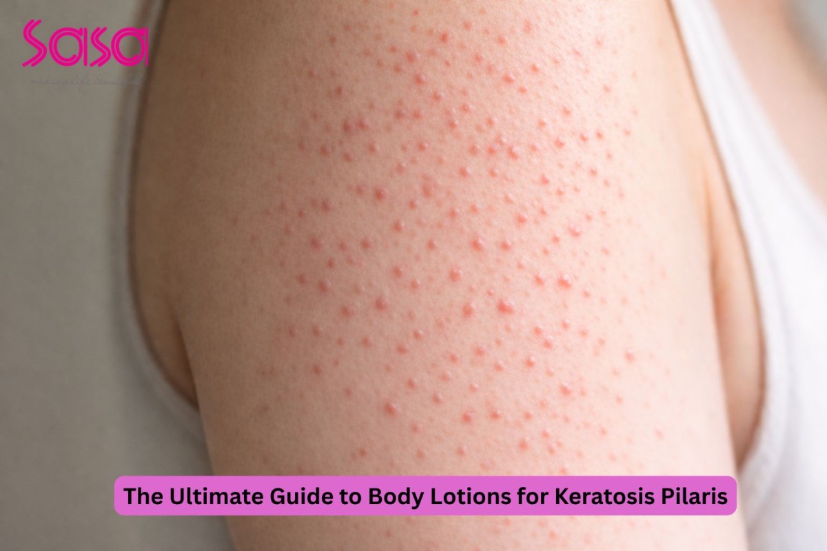 The Ultimate Guide to Body Lotions for Keratosis Pilaris