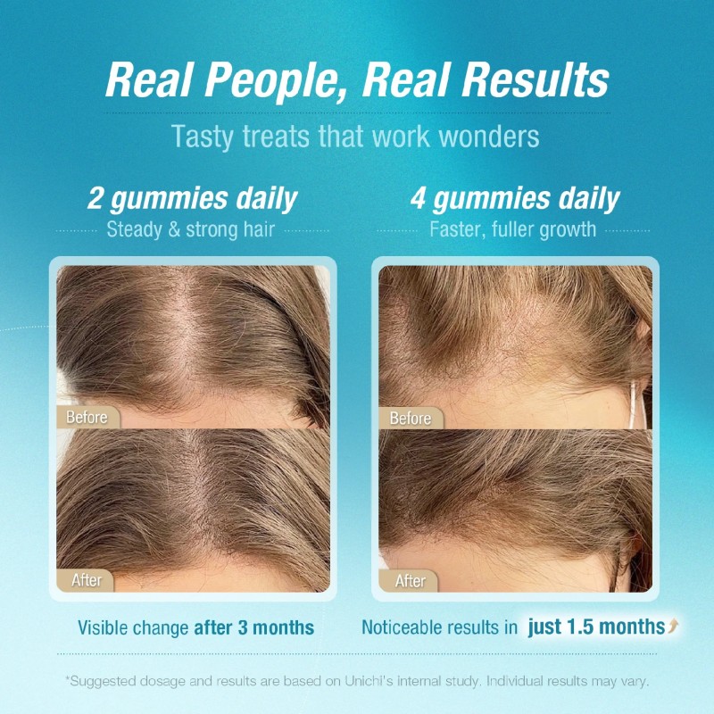 TEDDI LAB HAIR BOOST GUMMY PLUS (180G)